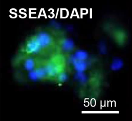 Fluorescence microscope image on a black background: a loose cluster of cells glowing green, with round blue nuclei inside it and a fainter green patch to the upper right. Labeled "SSEA3/DAPI", with a 50 micrometer scale bar.
