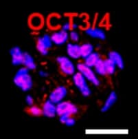 Fluorescence image on a black background of a round cluster of about 25 cells. The nuclei are blue and many glow pink to magenta, with fine red specks around them. Labeled "OCT3/4" in red, with a white scale bar.
